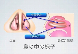 耳鼻科医が解説する「鼻づまり」のメカニズム