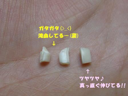 ルナの歯２